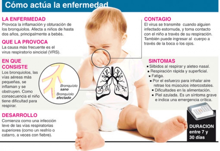 Infografía virus sincicial respiratorio