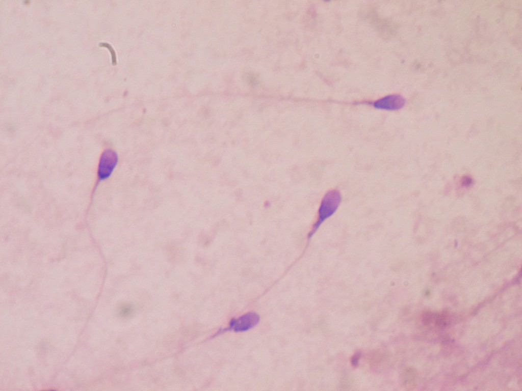 espermatozoides-mqs-2