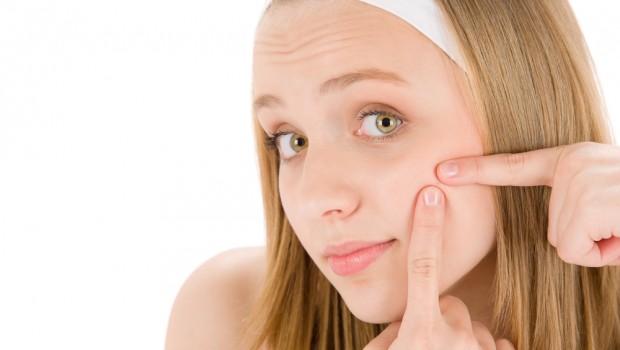 remedios contra el acné